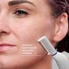 Michael Todd Beauty - Sonicsmooth ‚Äì SONIC Technology Dermaplaning Tool - 2 in 1 Women's Facial Exfoliation