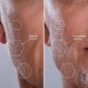 Michael Todd Beauty - Sonicsmooth ‚Äì SONIC Technology Dermaplaning Tool - 2 in 1 Women's Facial Exfoliation